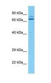 Anti-ALDH18A1, (N-terminal) antibody produced in rabbit affinity isolated antibody