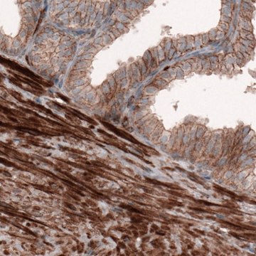 Monoclonal Anti-ACTB antibody produced in mouse Prestige Antibodies&#174; Powered by Atlas Antibodies, clone CL3868, purified immunoglobulin, buffered aqueous glycerol solution