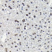 Anti-Phospho-ERK1-T202 + ERK2-T185 antibody produced in rabbit