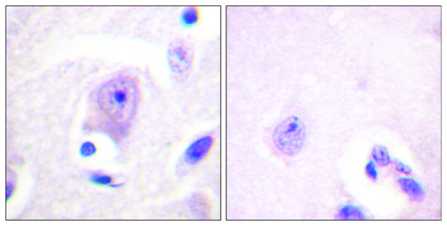 Anti-CDC6 antibody produced in rabbit affinity isolated antibody