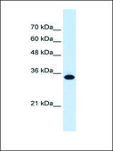 Anti-SLC25A38 antibody produced in rabbit affinity isolated antibody