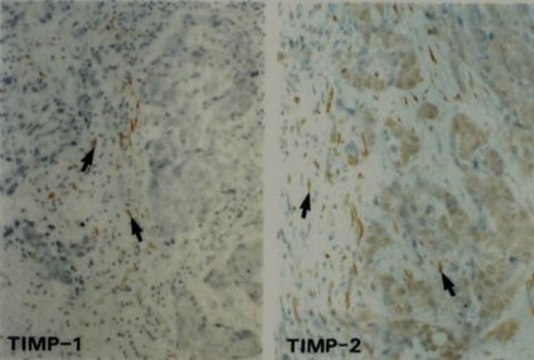 Anti-TIMP-2 Antibody, clone 67-4H11 clone 67-4H11, Chemicon&#174;, from mouse