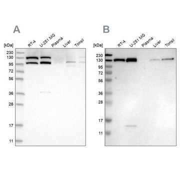 Anti-XPO5 antibody produced in rabbit Prestige Antibodies&#174; Powered by Atlas Antibodies, affinity isolated antibody, buffered aqueous glycerol solution, ab1