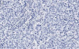 Anti-Skp2 Antibody, clone 1B13 ZooMAb® Rabbit Monoclonal recombinant, expressed in HEK 293 cells