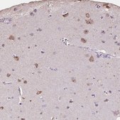 Anti-PNMA2 antibody produced in rabbit Prestige Antibodies® Powered by Atlas Antibodies, affinity isolated antibody, buffered aqueous glycerol solution