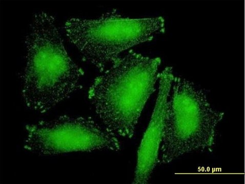 Anti-SORBS2 antibody produced in mouse purified immunoglobulin, buffered aqueous solution