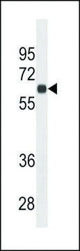 MONOCLONAL ANTI-CD138 (C-TERMINAL) antibody produced in mouse clone 587CT7.3.6.5, crude ascites, buffered aqueous solution