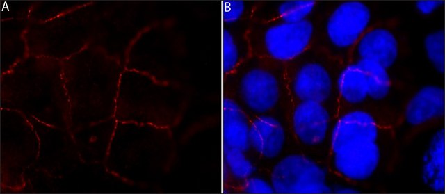 Monoclonal Anti-PLEKHA7 antibody produced in mouse clone PLK7, purified from hybridoma cell culture