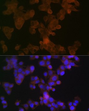 Anti-APOL1 antibody produced in rabbit