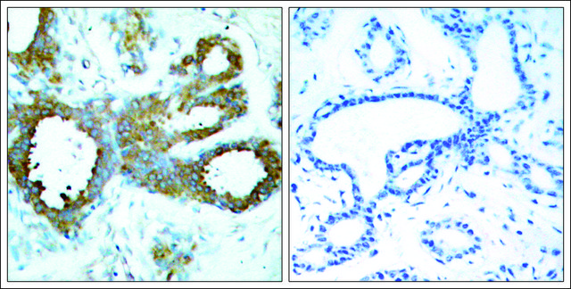 Anti-phospho-PAK1/PAK2/PAK3 (pThr423/pThr402/pThr421) antibody produced in rabbit affinity isolated antibody