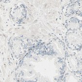 Anti-BCAN antibody produced in rabbit Prestige Antibodies® Powered by Atlas Antibodies, affinity isolated antibody, buffered aqueous glycerol solution