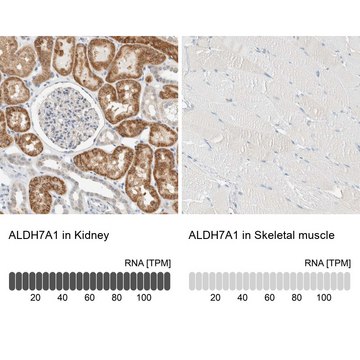 Anti-ALDH7A1 antibody produced in rabbit Prestige Antibodies&#174; Powered by Atlas Antibodies, affinity isolated antibody, buffered aqueous glycerol solution