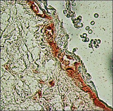 Anti-Fibroblast Growth Factor Receptor-3, Extracellular antibody produced in rabbit affinity isolated antibody, buffered aqueous solution