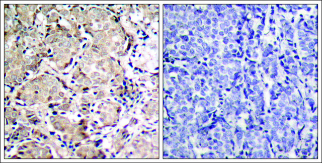 Anti-phospho-FOXO1 (pSer319) antibody produced in rabbit affinity isolated antibody