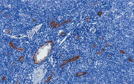 Anti-vWF Antibody, clone 1B21, ZooMAb® Rabbit Monoclonal recombinant, expressed in HEK 293 cells