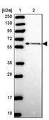 Anti-ZNF530 antibody produced in rabbit Prestige Antibodies® Powered by Atlas Antibodies, affinity isolated antibody, buffered aqueous glycerol solution