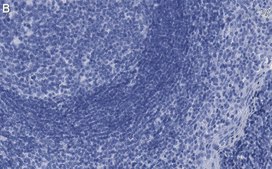 Anti-p-ZAP-70 (Tyr319) Antibody, clone 1B10 ZooMAb® Rabbit Monoclonal recombinant, expressed in HEK 293 cells