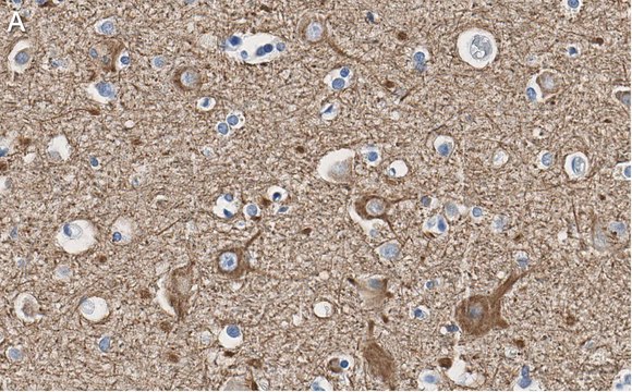 Anti-Neurofilament L Antibody, clone 1E13 ZooMAb&#174; Rabbit Monoclonal recombinant, expressed in HEK 293 cells