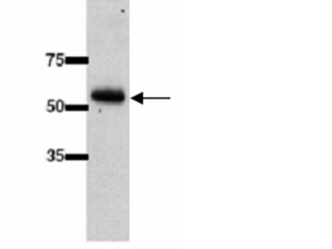 Anti-UGT2B7 Antibody (UDP-Glycosyltransferase 2B family, polypeptide 7) serum, Chemicon&#174;