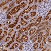 Anti-ATP6V1E1 antibody produced in rabbit Prestige Antibodies® Powered by Atlas Antibodies, affinity isolated antibody, buffered aqueous glycerol solution
