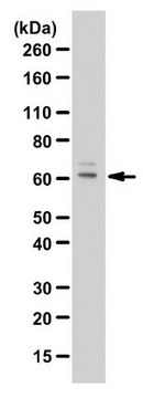 Anti-CYP24A1 Antibody from rabbit, purified by affinity chromatography