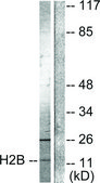 Anti-Histone H2B (Acetyl-Lys15) antibody produced in rabbit affinity isolated antibody