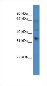 Anti-OR1D2 antibody produced in rabbit affinity isolated antibody