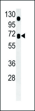 ANTI-ASB15 (CENTER) antibody produced in rabbit IgG fraction of antiserum, buffered aqueous solution