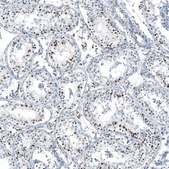 Anti-NRG1 antibody produced in rabbit Prestige Antibodies® Powered by Atlas Antibodies, affinity isolated antibody, buffered aqueous glycerol solution