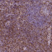 Monoclonal Anti-S100A4 antibody produced in mouse Prestige Antibodies® Powered by Atlas Antibodies, clone CL0239, purified immunoglobulin, buffered aqueous glycerol solution