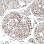 Anti-PAPD5 antibody produced in rabbit Prestige Antibodies® Powered by Atlas Antibodies, affinity isolated antibody, buffered aqueous glycerol solution
