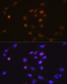 Anti-Phospholipid Scramblase 1 (PLSCR1) antibody produced in rabbit