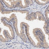 Anti-RAB13 antibody produced in rabbit Prestige Antibodies® Powered by Atlas Antibodies, affinity isolated antibody, buffered aqueous glycerol solution