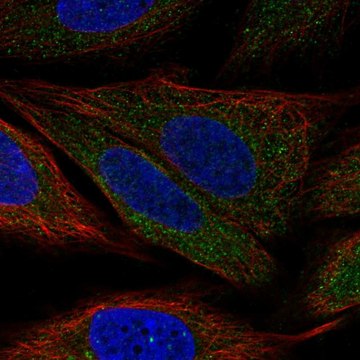 Anti-Pdpk1 Antibody Produced In Rabbit Prestige Antibodies&#174; Powered by Atlas Antibodies, affinity isolated antibody, buffered aqueous glycerol solution