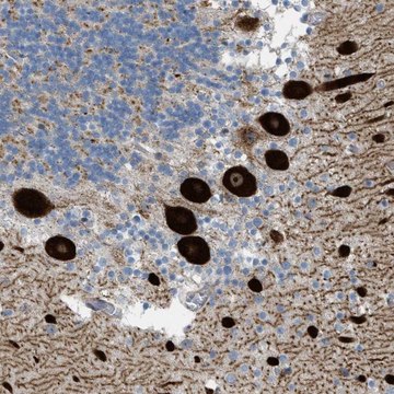 Anti-ATP2A3 antibody produced in rabbit Prestige Antibodies&#174; Powered by Atlas Antibodies, affinity isolated antibody, buffered aqueous glycerol solution