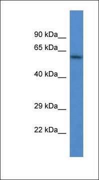 Anti-HPSE antibody produced in rabbit affinity isolated antibody