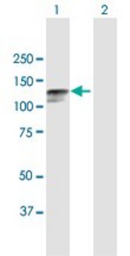 Anti-DSC2 antibody produced in mouse purified immunoglobulin, buffered aqueous solution