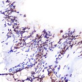 Anti- JMJD6 antibody produced in rabbit