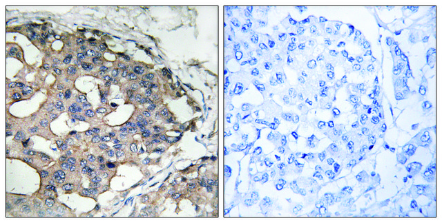 Anti-B-RAF antibody produced in rabbit affinity isolated antibody