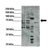 Anti-RAD17 antibody produced in rabbit IgG fraction of antiserum