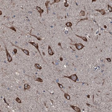 Anti-SLC25A38 antibody produced in rabbit Prestige Antibodies&#174; Powered by Atlas Antibodies, affinity isolated antibody, buffered aqueous glycerol solution