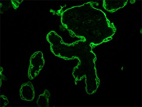 Monoclonal Anti-Cytokeratin Peptide 18 antibody produced in mouse clone CY-90, ascites fluid