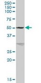Anti-GK antibody produced in mouse IgG fraction of antiserum, buffered aqueous solution