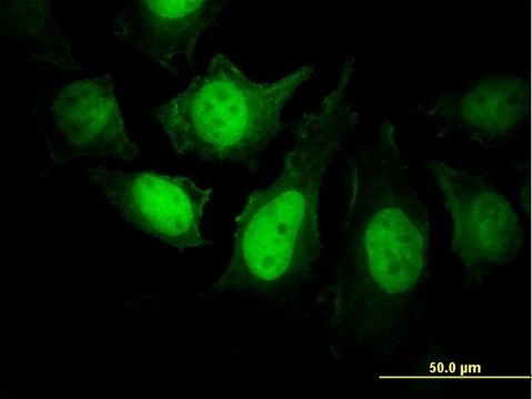 Monoclonal Anti-PPP3R1 antibody produced in mouse clone 4E1, purified immunoglobulin, buffered aqueous solution