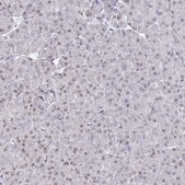 Anti-TRIP12 antibody produced in rabbit Prestige Antibodies® Powered by Atlas Antibodies, affinity isolated antibody, buffered aqueous glycerol solution