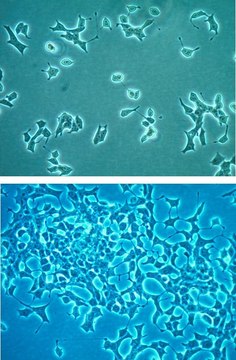 INS-1 832/3大鼠胰岛素瘤细胞系 INS-1 832/3 rat insulinoma cell line is a useful model for insulin secretion regulation and pancreatic islet beta-cell function studies.