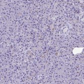Anti-CPVL antibody produced in rabbit Prestige Antibodies® Powered by Atlas Antibodies, affinity isolated antibody, buffered aqueous glycerol solution