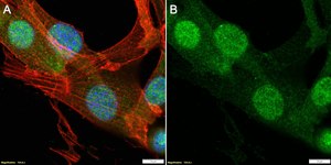 Anti-S100A4 Antibody, clone 1G2 ZooMAb® Rabbit Monoclonal recombinant, expressed in HEK 293 cells
