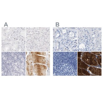 Anti-MYBPC1 antibody produced in rabbit Prestige Antibodies&#174; Powered by Atlas Antibodies, affinity isolated antibody, buffered aqueous glycerol solution