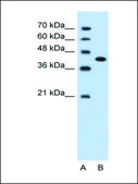Anti-CEACAM6 IgG fraction of antiserum